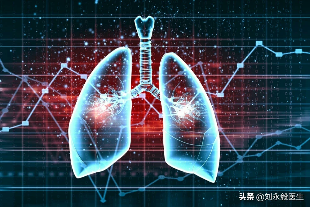 肺癌扩散了只能活三个月吗？