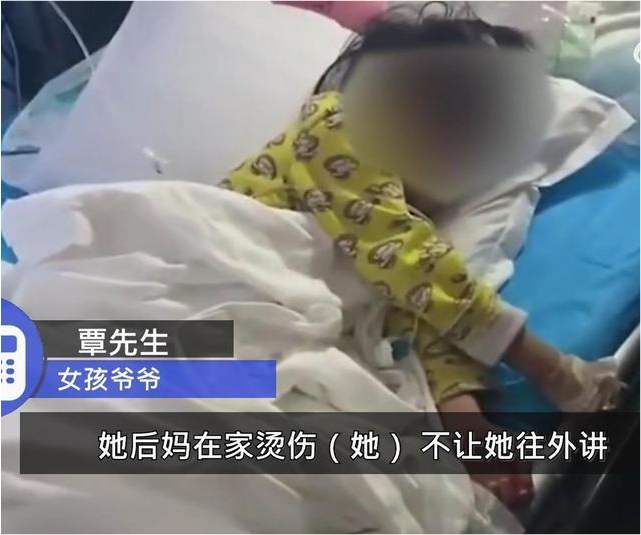 贵州4岁女孩被虐待 双脚烫伤严重需截肢 爷爷发声后妈很凶