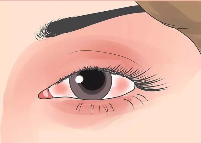 眼皮跳是什么原因（用科学来解释迷信）