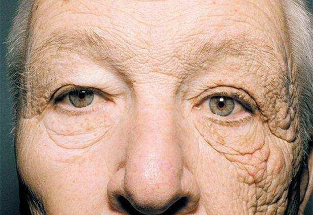 面部抗衰老护肤品有哪些，黛莱美抗衰小金盒带走6大顽固皱纹