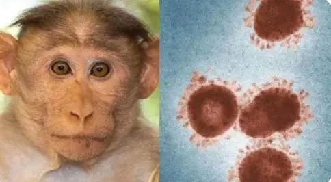 猴痘病毒传播速度前所未有，致死率高达11%，为何爆发如此巧合？
